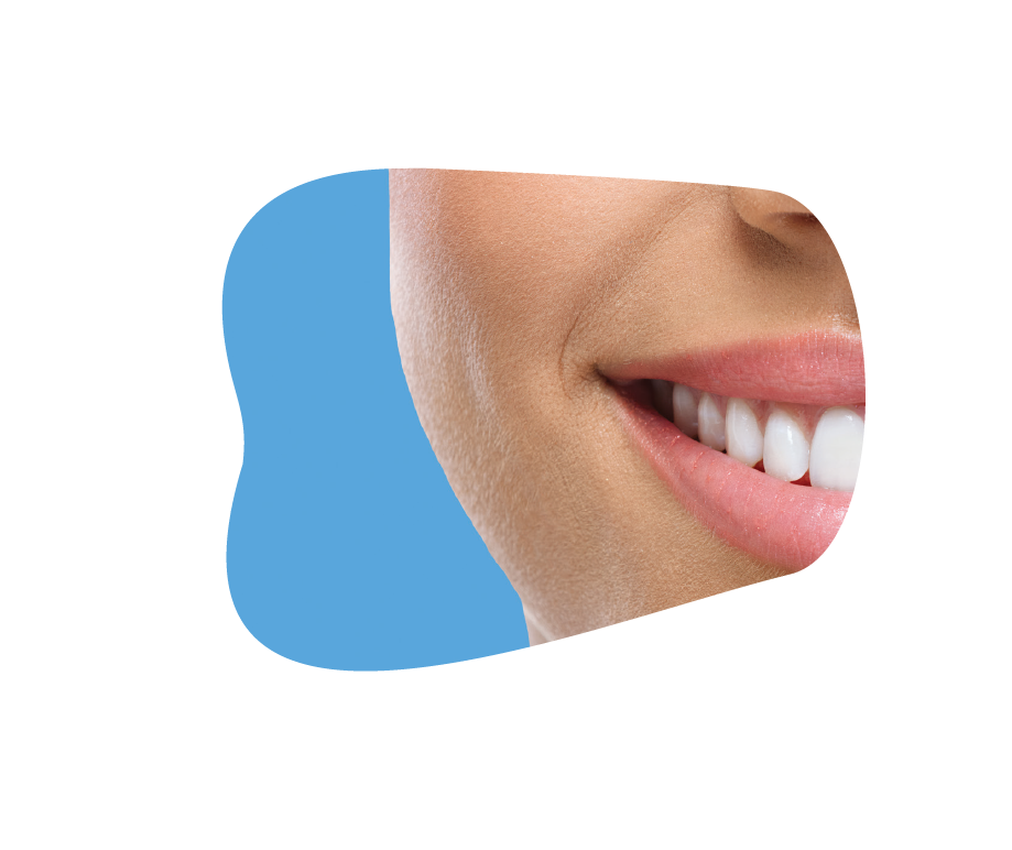 Riofoto Smile