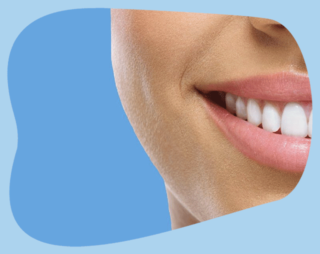 riofoto-dental-smile